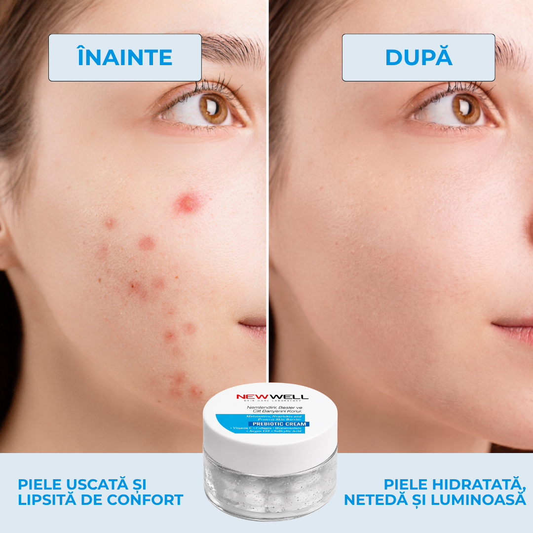 Noua cremă probiotică Well